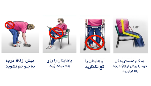 نکات لگن